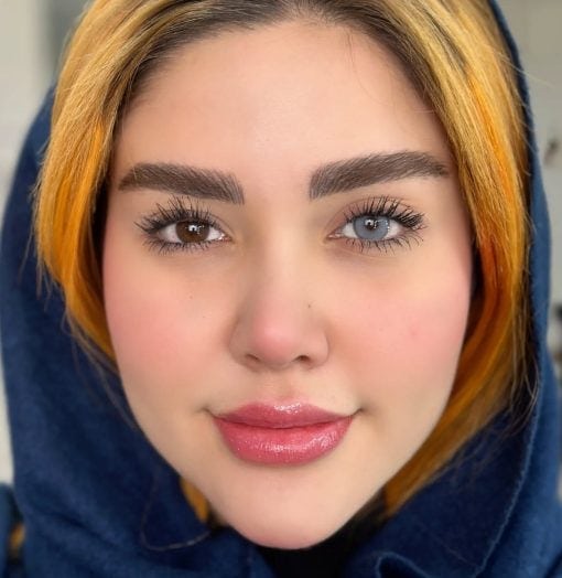 خرید لنز آیس کالر رادین اسکای
