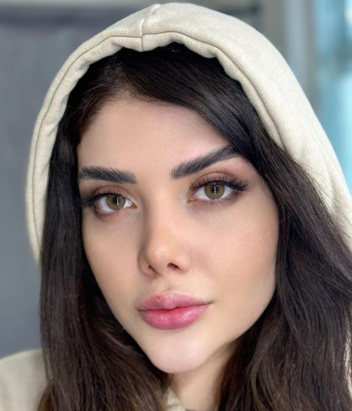 خرید لنز آیس کالر رادین گلد