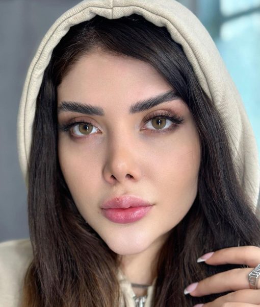 خرید لنز آیس کالر رنگ رادین گلد