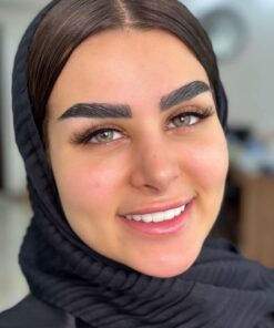 خرید لنز یونیک رنگ آلاماندا