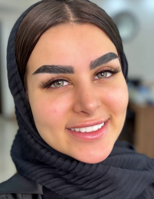 خرید لنز یونیک رنگ آلاماندا