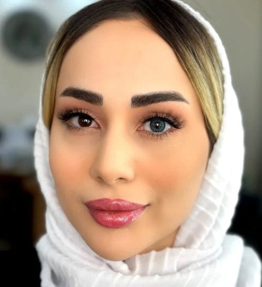 خرید لنز یونیک مگنولیا