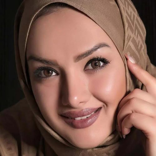 خرید لنز عسلی دور دار Brown Tone3