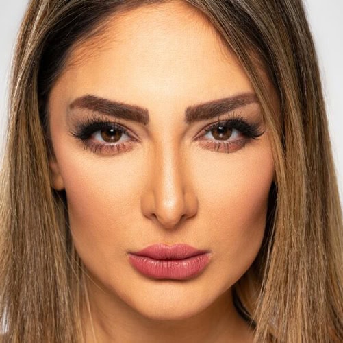 خرید لنز عسلی دور دار Brown Tone3