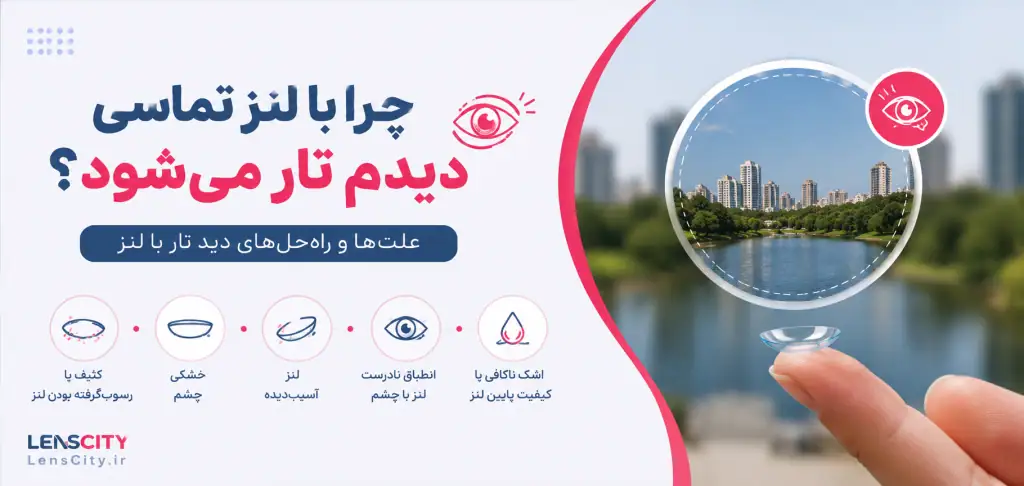 تاری دید بعد گذاشتن لنز در چشم