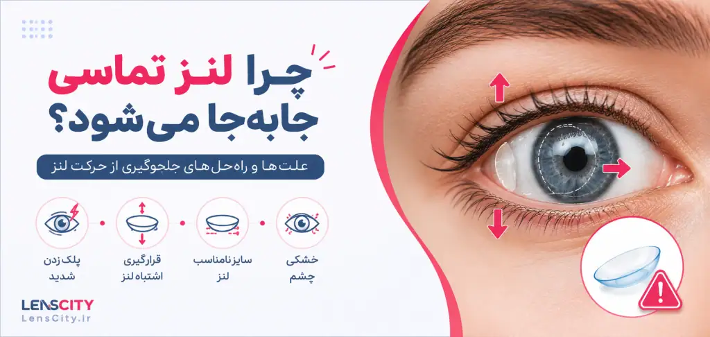 چرا لنز در چشم حرکت میکند؟