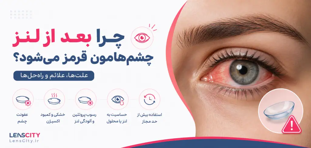 قرمزی چشم بعد از لنز