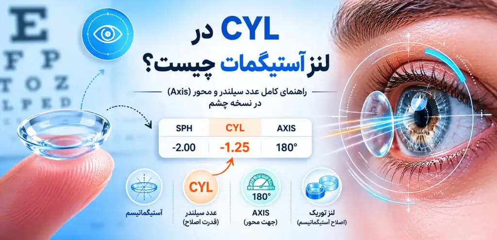 سیلندر CYL در لنز آستیگمات چیست؟