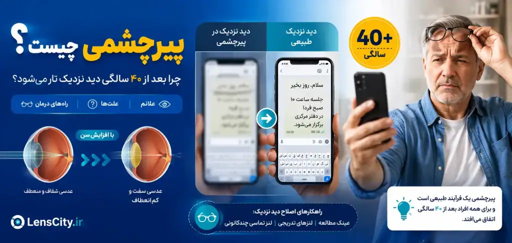 پیرچشمی چیست و چه علائمی دارد؟